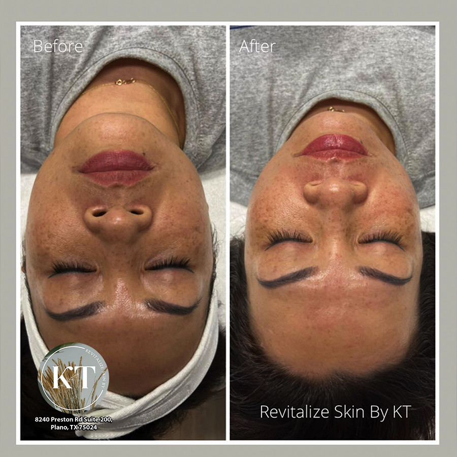 REVITALIZE SKIN BY KT - Best day spa Plano, TX 75024